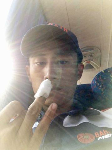 001 阿凱在換輪時不慎被飛輪刺傷無名指